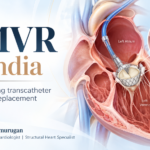 TMVR vs MitraClip in India - transcatheter mitral valve replacement by Dr A B Gopalamurugan
